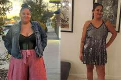 Vanessa before and after Gastric Sleeve Surgery at UCLA