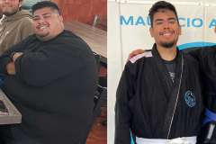 Before and After Gastric Sleeve Surgery