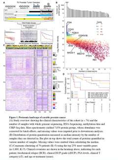 Boutros research paper showing charts of proteomic landscape of curable prostate cancer