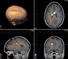 Positron Emission Tomography (PET)