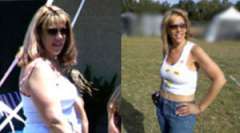 Cari's Story - Weight Loss Surgery: Roux-en-Y Gastric Bypass