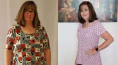 Charlotte's Story - Weight Loss Surgery: Gastric Sleeve
