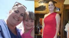 Danielle's Story - Weight Loss Surgery: Gastric Sleeve