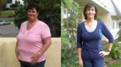 Denise's Story - Weight Loss Surgery: Roux-en-Y Gastric Bypass