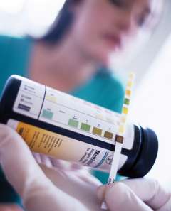 Woman holding ketone strips. Blood Glucose check - Diabetes program.