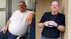 Frank's Story - Weight Loss Surgery: Gastric Sleeve