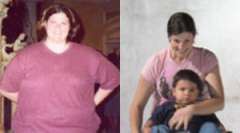 Gina's Story - Weight Loss Surgery: Roux-en-Y Gastric Bypass