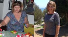 Heather's Pictures - Bariatric Surgery