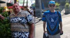 James' Story - Weight Loss Surgery: Gastric Sleeve