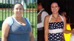 Jamie's Pictures - Weight Loss Surgery: Gastric Sleeve