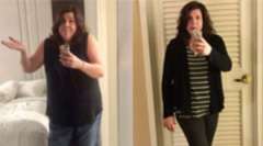 Jean's Story - Weight Loss Surgery: Gastric Sleeve