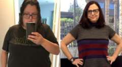 Kristen's Story - Weight Loss Surgery: Lap Band Revision