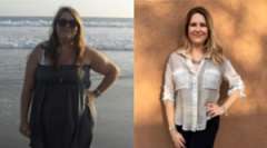 Krystyn's Story - Weight Loss Surgery: Gastric Sleeve