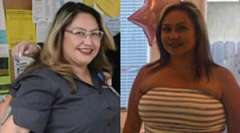 Lolita's Story - Weight Loss Surgery: Gastric Sleeve