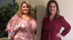 Lori's Story - Weight Loss Surgery: Gastric Sleeve
