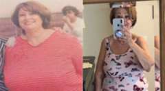 Margarita's Story - Weight Loss Surgery: Gastric Sleeve