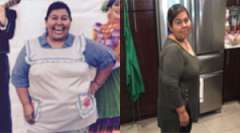 Maria's Story - Weight Loss Surgery: Gastric Sleeve Surgery