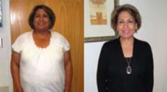Martha's Story - Weight Loss Surgery: Gastric Sleeve