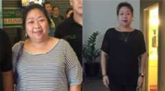 Mervilyn's Story - Weight Loss Surgery: Roux-en-Y Gastric Bypass