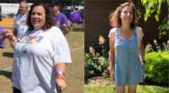 Michaele's Story - Weight Loss Surgery: Gastric Sleeve