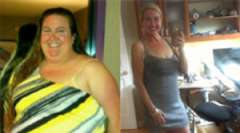 Michelle Boskin's Story - Weight Loss Surgery: Roux-en-Y Gastric Bypass