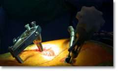 Minimally Invasive Sextant