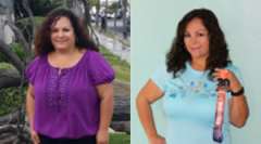Monica's Story - Weight Loss Surgery: Gastric Sleeve