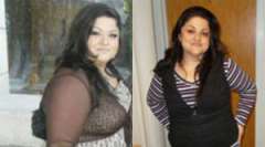 Olga's Story - Weight Loss Surgery: Gastric Sleeve