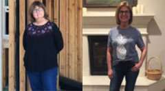 Rebecca's Story - Weight Loss Surgery: Gastric Sleeve