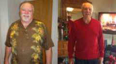 Robert's Story - Weight Loss Surgery: Gastric Sleeve