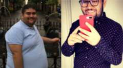 Rogelio's Story - Weight Loss Surgery: Gastric Sleeve