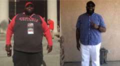 Samuel's Story - Weight Loss Surgery: Gastric Sleeve