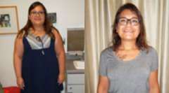 Sarah's Story - Weight Loss Surgery: Gastric Sleeve