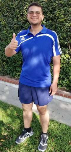 Before and After Gastric Sleeve Surgery