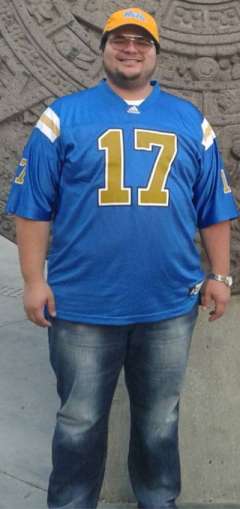 Before and After Gastric Sleeve Surgery