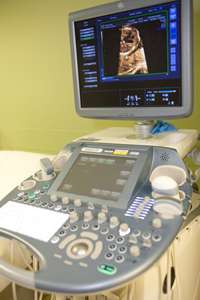 Fetal Cardo Machine