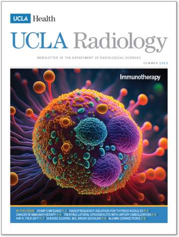 UCLA Radiology Newsletter Summer 2023