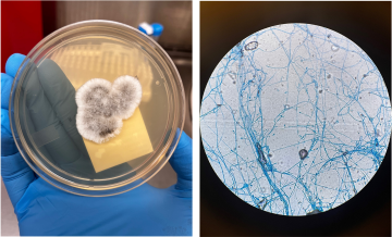 Gloved hand holds a petri dish with mold growth, alongside a microscope view of blue-stained fungal hyphae. 