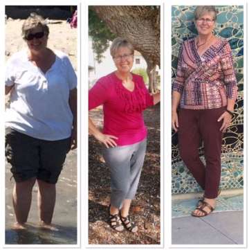 Angelika before and after bariatric surgery