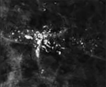Coarse Heterogeneous Calcifications