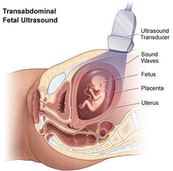 Illustration of Fetal Ultrasound