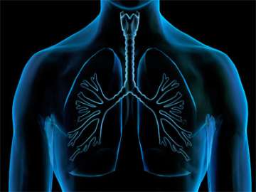 An illustrated x-ray of the lungs