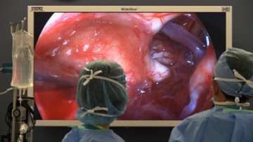 Doctors looking at optic nerve on giant screen