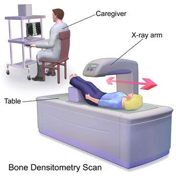 Bone Density Scan