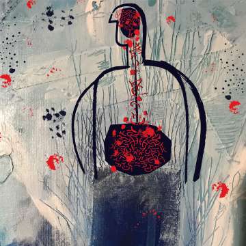 IBD - Inflammatory Bowel Diseases