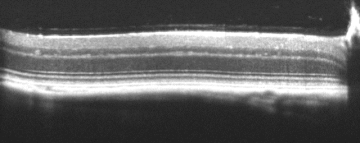 Bioptigen sdOCT Retinal Image
