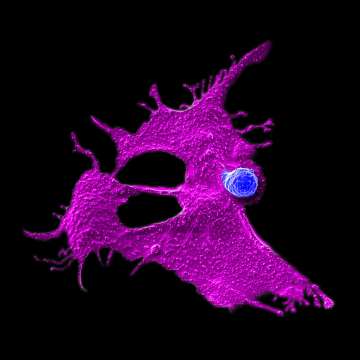 Electron microscopy (SEM) images showing a CAR-NKT cell (blue) attacking tumor cells (magenta).