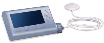 Diabetes - insulin pump, infusion set issues