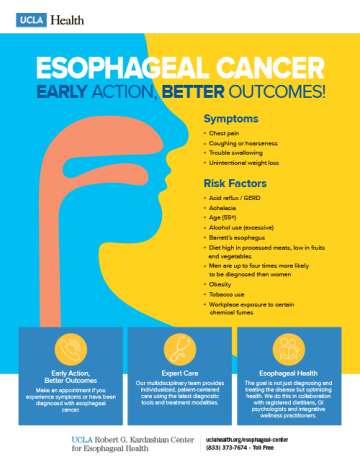 Esophageal Cancer Symptoms and Risk Factors