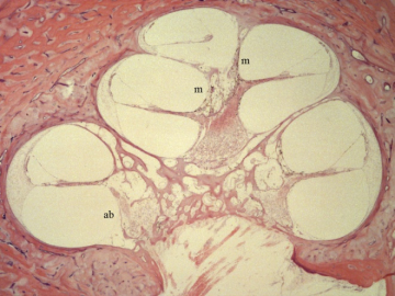 cochlea showing melanin in apicaland middle segments but none in the anterior basal segment